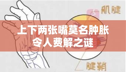 上下两张嘴莫名肿胀令人费解之谜 上下两张嘴莫名肿胀令人费解之谜